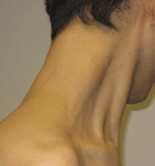 ขอขอบคุณภาพประกอบจาก : stopmusclepain.com